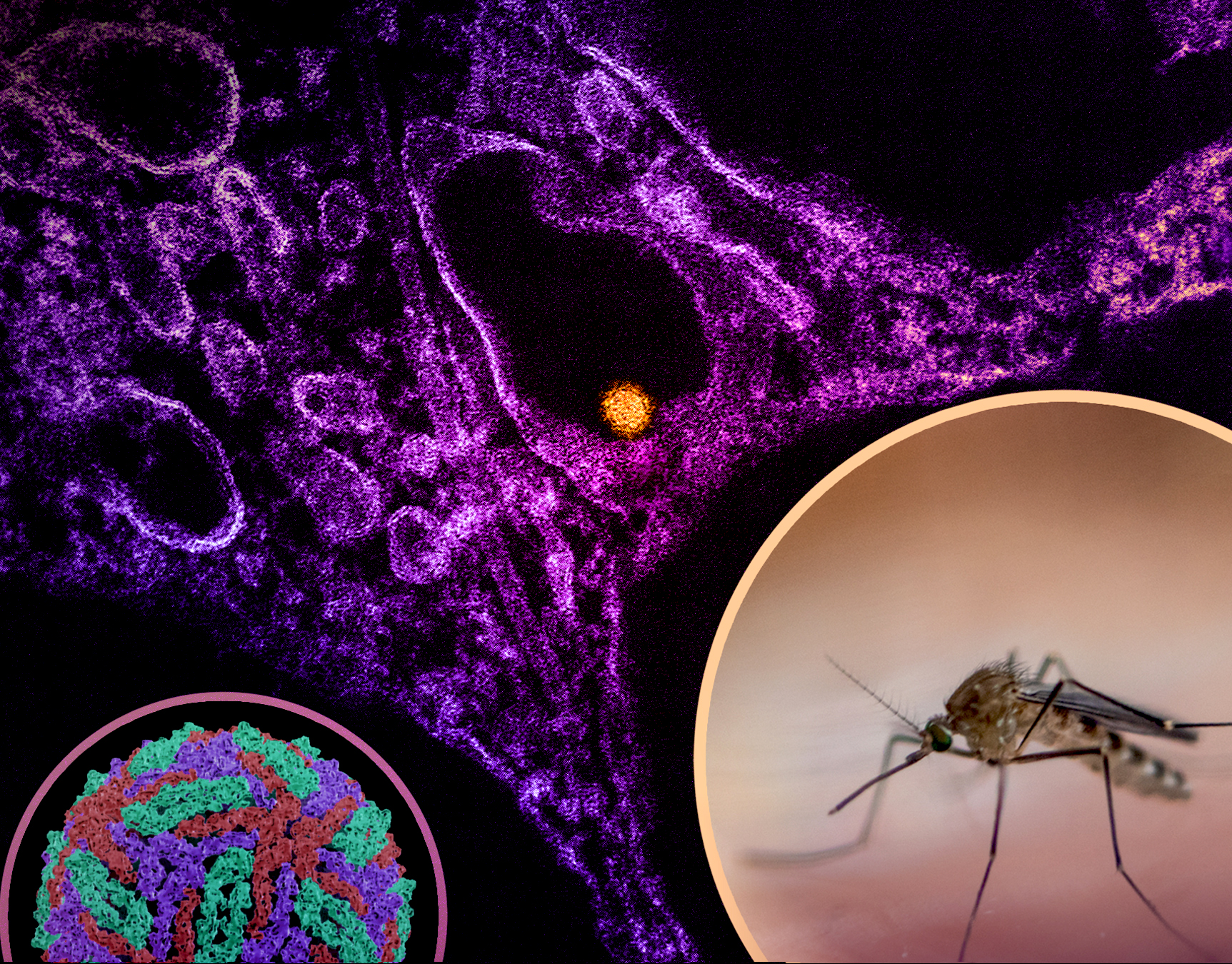 A composite scientific illustration showing a microscopic view of West Nile virus cells and a close-up photo of a mosquito on human skin.